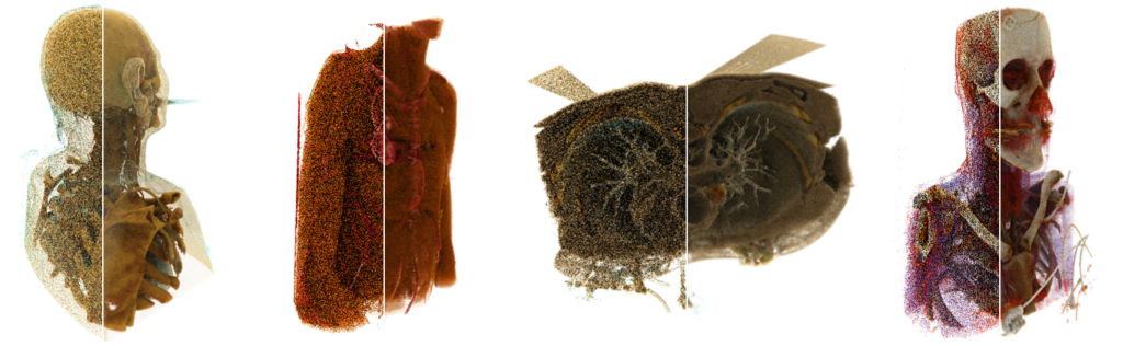 Adaptive Temporal Sampling for Volumetric Path Tracing of Medical Data